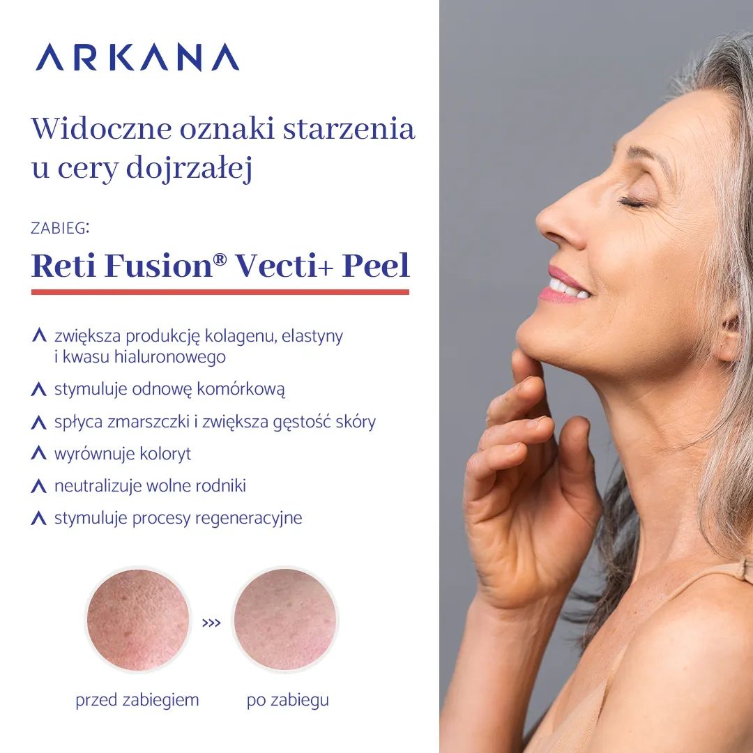 Reti Fusion Vecti Therapy - Arkana EN